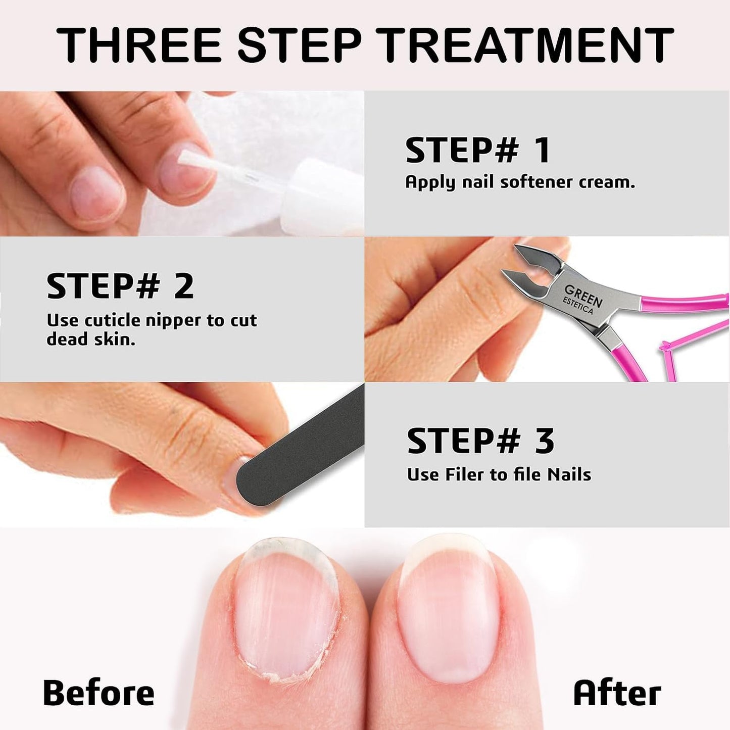 Professional Cuticle Trimmer Nail Cuticle Cutter Stainless Steel Cuticle Nippers with Sharp Blades of Cuticle Remover Clippers Manicure Tools Double Spring - Pedicure Nail Tools (Pink - 4 Pack)