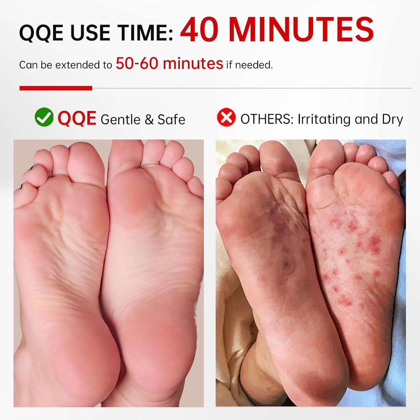 7 Pack Foot Peeling Mask, Hydrating Exfoliating Foot Mask for Dry Cracked Feet, Callus Remover & Cracked Heel Repair & Foot Care