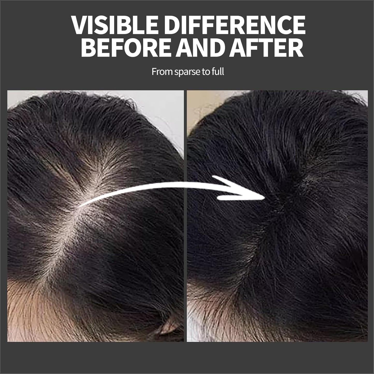 Hair Building Fibers - Instant Volume for Thinning Hair, Natural Appearance with Electrostatic Adsorption,Plant-Based, All-Day Hold, 25G Black