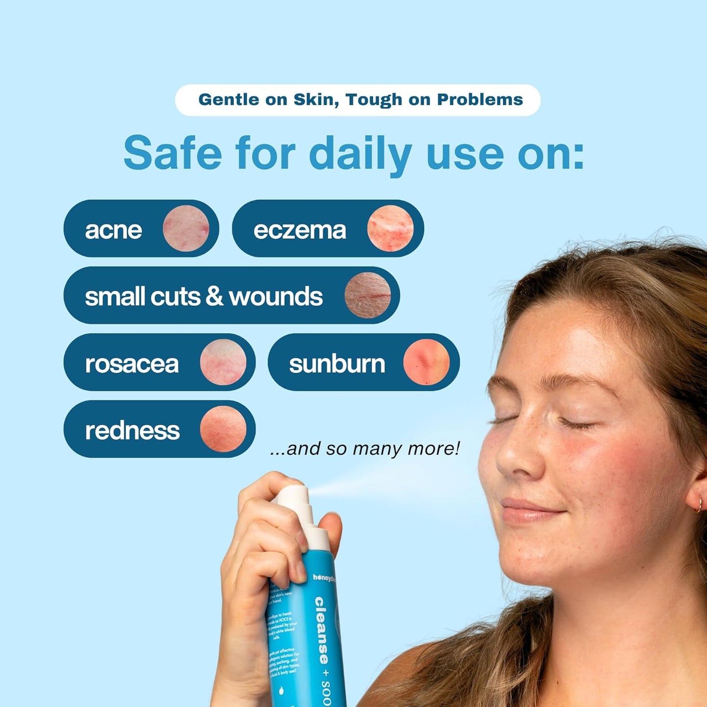 Hypochlorous Acid Spray – HOCl Face & Body Mist for Acne, Eczema & Irritation – Multi-Purpose Skin Repair – Eyelid Cleanser, Post-Workout/Procedure, Scalp & Sensitive Skin (2 oz+6.8 oz)