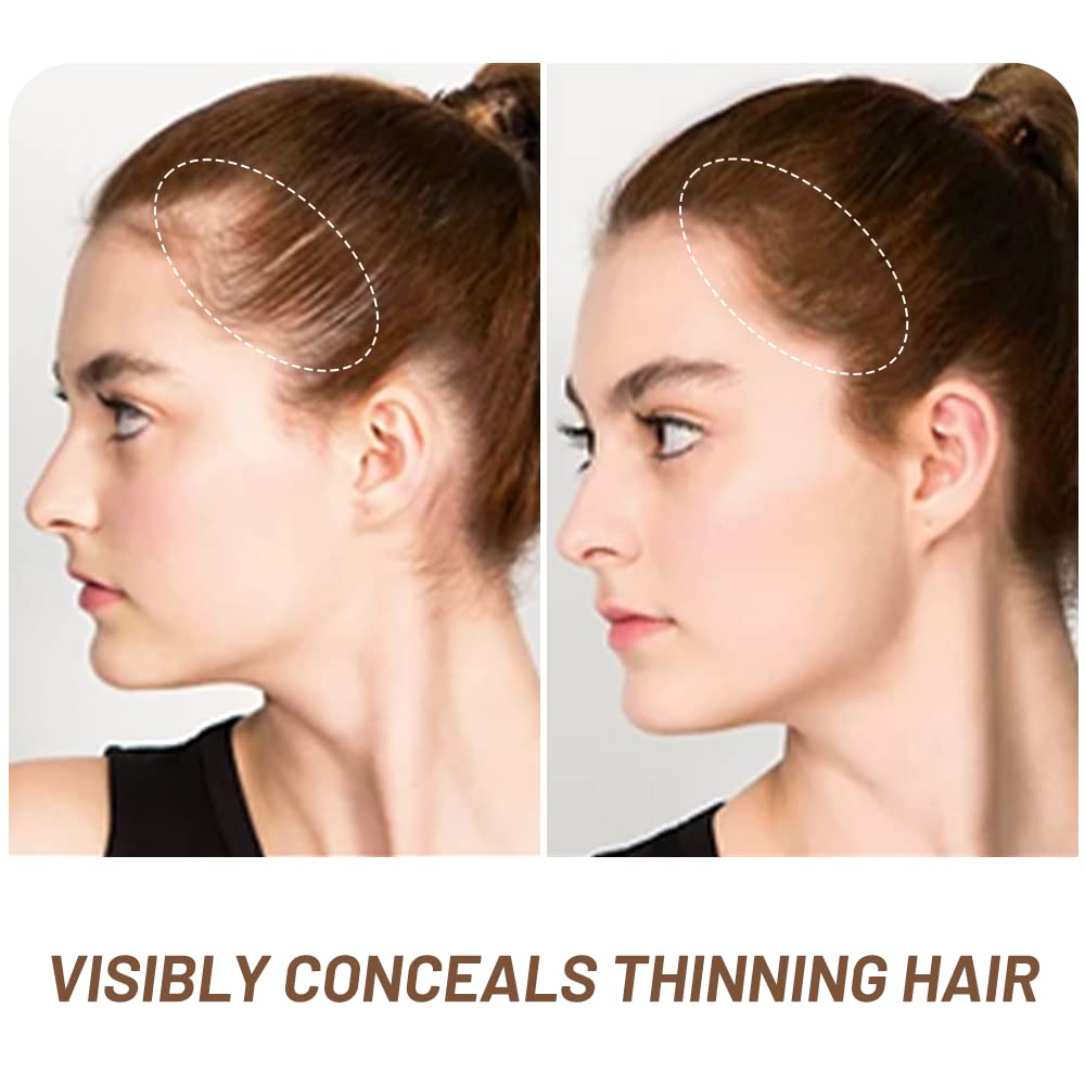 Root Touch Up Hair Powder, Instantly Gray Hair Root Cover Up Hairline Powder, Hair Concealer For Women and Men (A-Brown, 2PC)