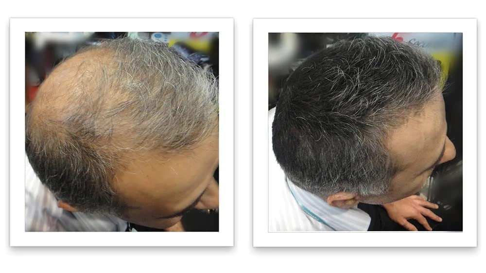 Caboki Hair Loss Concealer, 90-day supply, Dark Gray