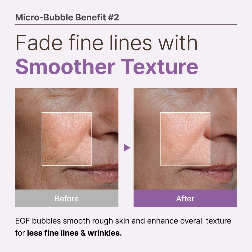 MENOKIN 30 Seconds Quick Bubble Mask [REPAIR] - [EGF Liposome] in Micro-bubbles for Skin Restoration, Hypoallergenic Bubble Capsule for Deep Repair, Korean Skin Care Essential, 70 Uses, fl.oz