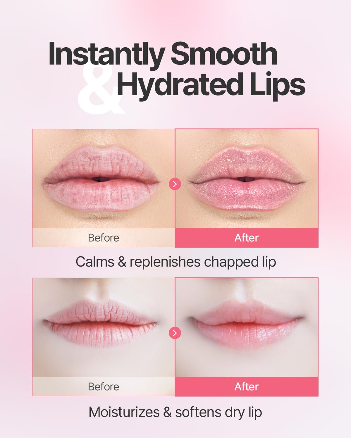 Aura Quartz Hydrogel Lip Mask 5ea - Moisturizing Lip Mask with Retinol, Peptide, Collagen, PDRN, Bakuchiol, Anti-aging Lip Care for Dry Lips, Reduces Laugh Lines, Smooth and Plump Lips