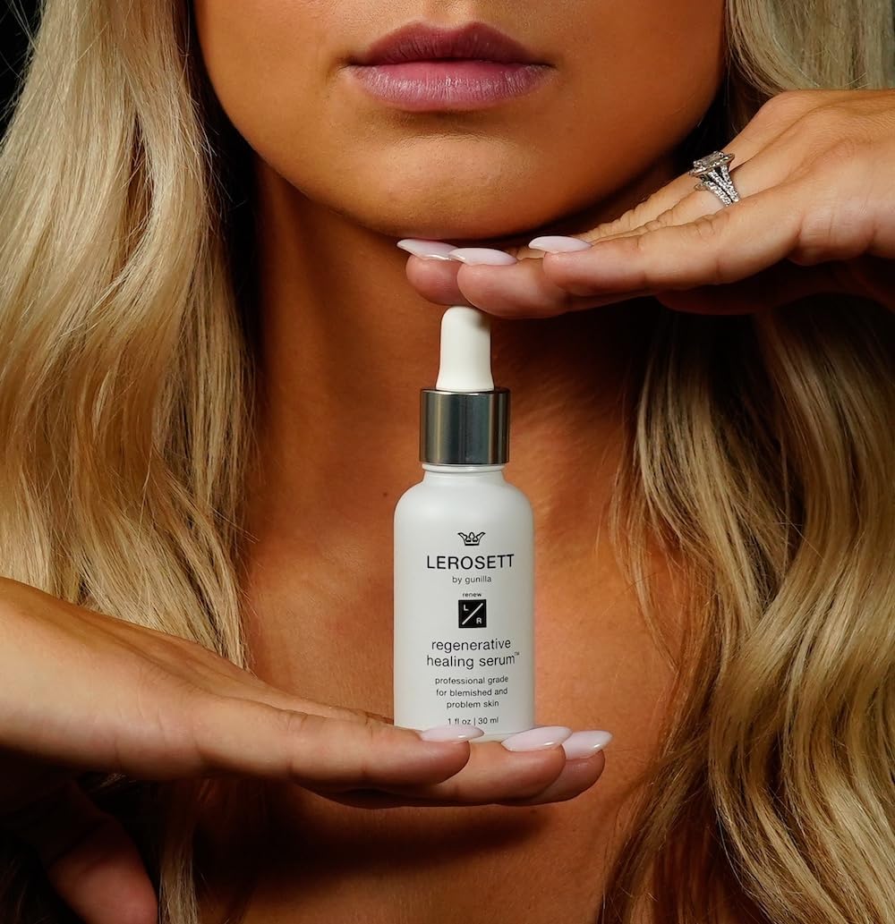 LEROSETT Serum for Acne Scarring Healing, Pimples, Redness, Breakouts, Blemishes, Hydrate & Soothes Irritated Skin, Natural Serum. Spa-Grade, Plant Based, Concentrated - 1 oz