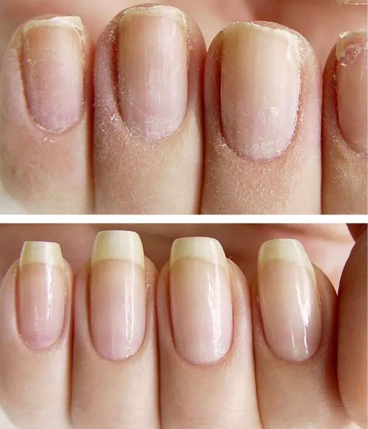 NAILVIVE Nail Serum Powerful Magic-like Silk Proteins Proven Natural Formula Strengthening Hardening nails Instantly Prevents Splits Chips Peels Cracks on Your Nails (PEN APPLICATOR)