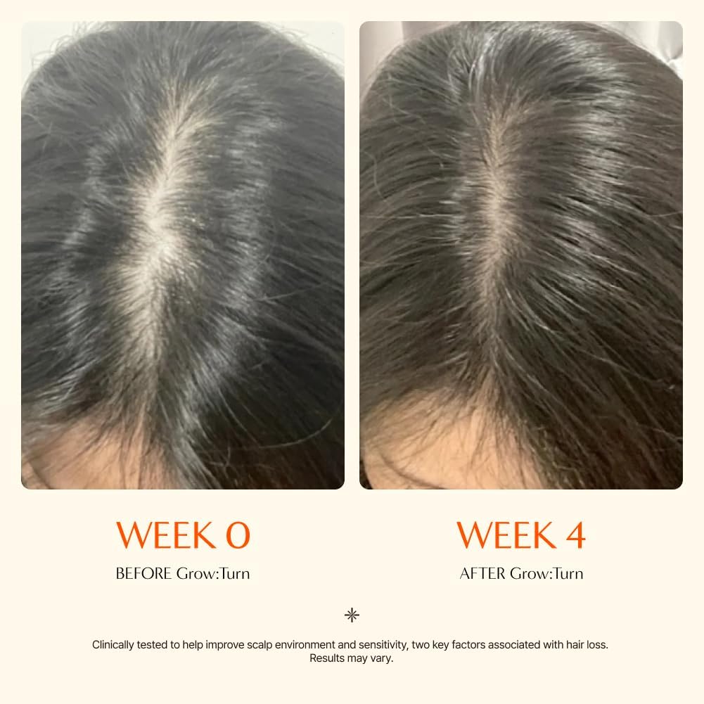 Growturn Hair Growth Serum with Built in Brush for Hair Growth & Thickening | Treatment for Thinning Hair, Hair Loss | Low Irritation, Fragrance-Free, Sulfate & Paraben-Free, 3.38 fl. oz. (Pack of 2)