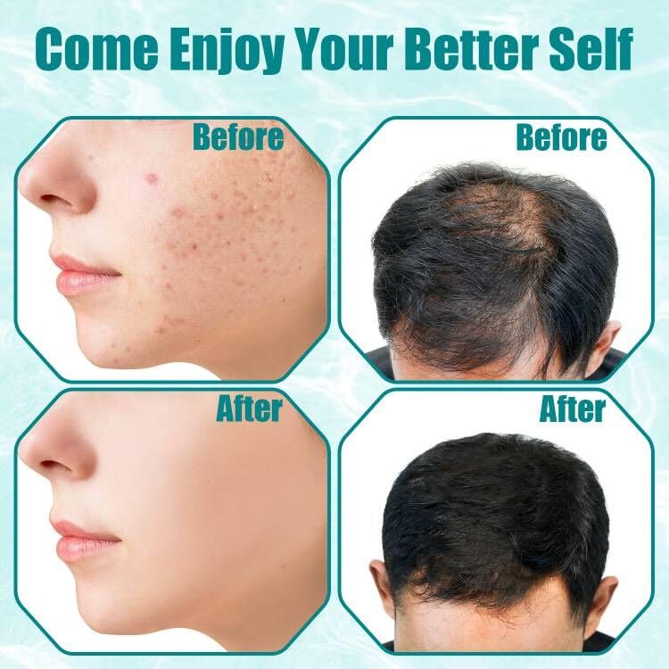 High Frequency Facial Wand - TUMAKOU Portable Violet High Frequency Facial Skin Machine - with 6 Glass Tubes