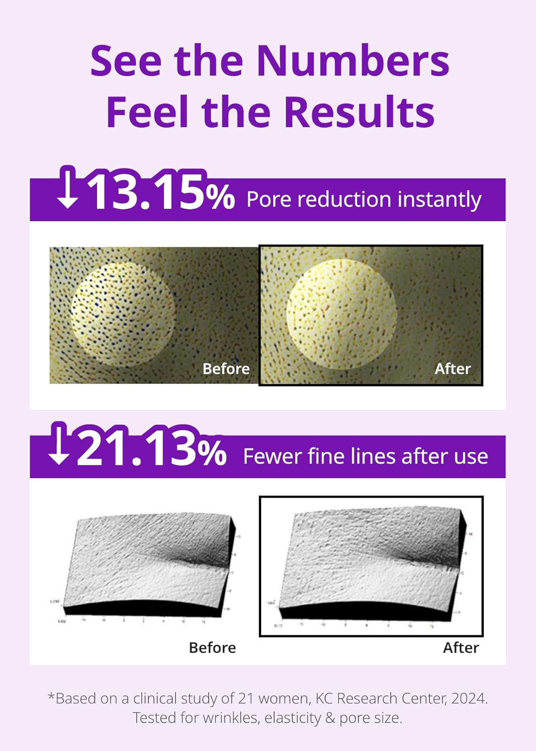 SNP 10,000ppm Deep Collagen + PDRN + Retinol Hydrogel Mask | 8 Layer 125Da Collagen Face Mask | Overnight Facial Mask | Patent Skin Hydration | Hydrating Facial Mask | Face Mask Skin Care | 4 Sheets