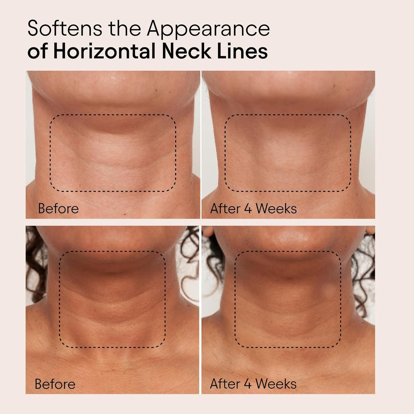 ALPYN Super Sculpt Serum, Face & Neck with Tri-Peptide Firming Complex, 1.7 oz