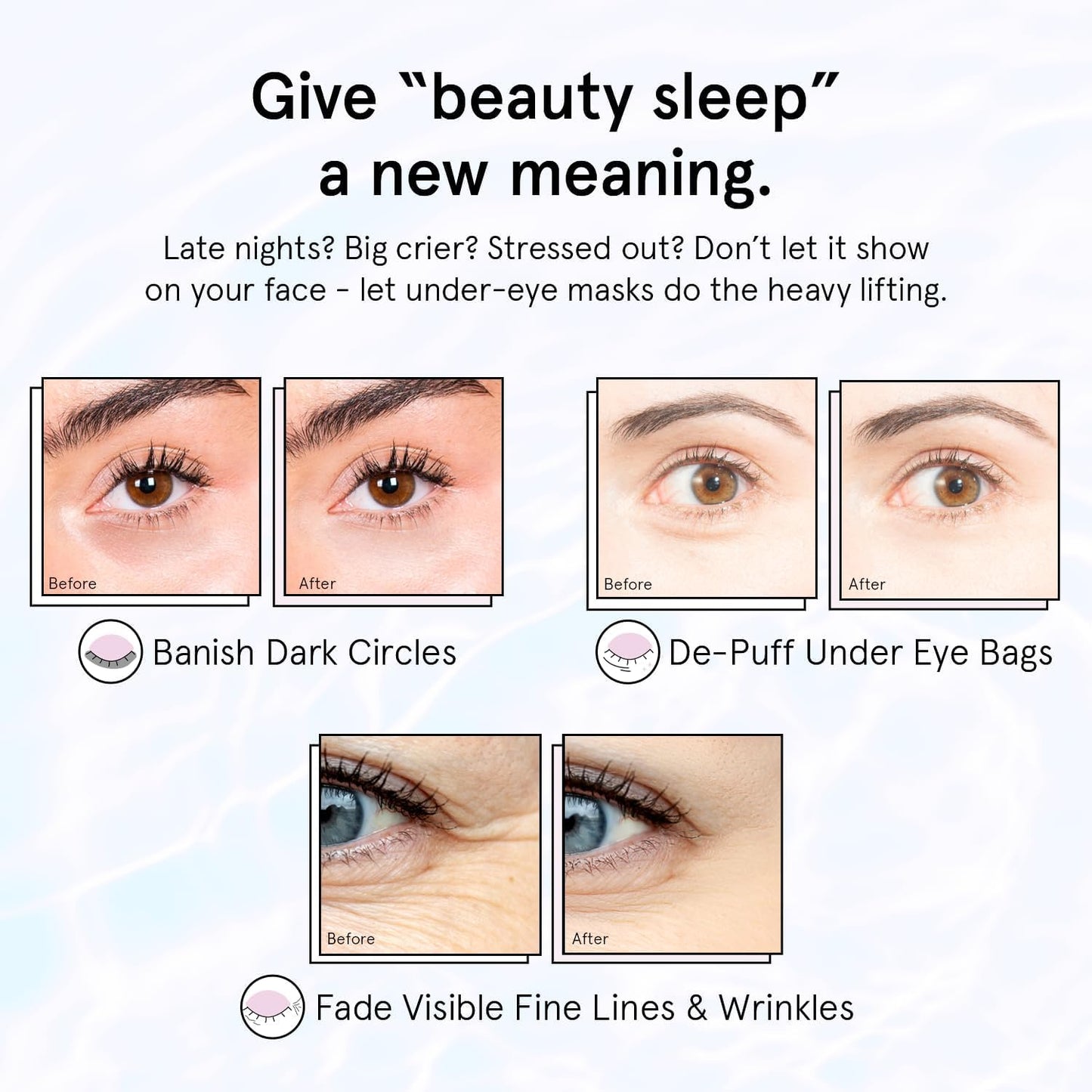 grace & stella Retinol Under Eye Patches for Puffy Eyes and Dark Circles - Restoring Gel Under Eye Masks with Hyaluronic Acid - Vegan Cruelty-Free Skincare, Birthday Gifts for Women (Purple, 48 Pairs)