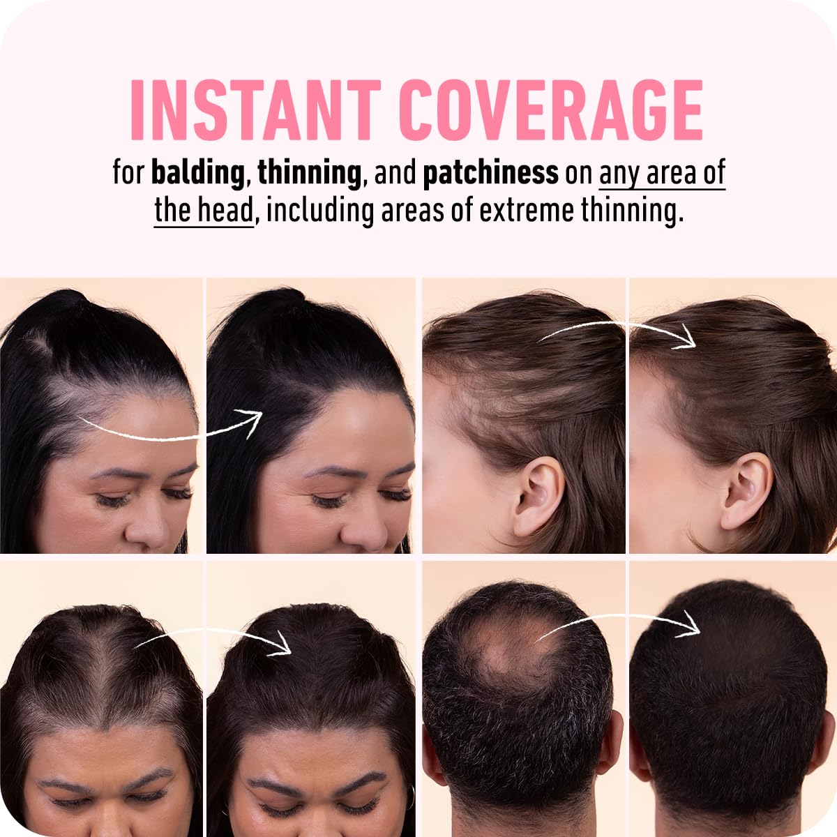 BOLDIFY Hairline Powder (LARGE, 10g) - Root Touch Up Hair Color for Gray Coverage - Bald Spot Concealing Hair Powder for Women & Men - 48-Hour Stain-Proof - Dark Gray