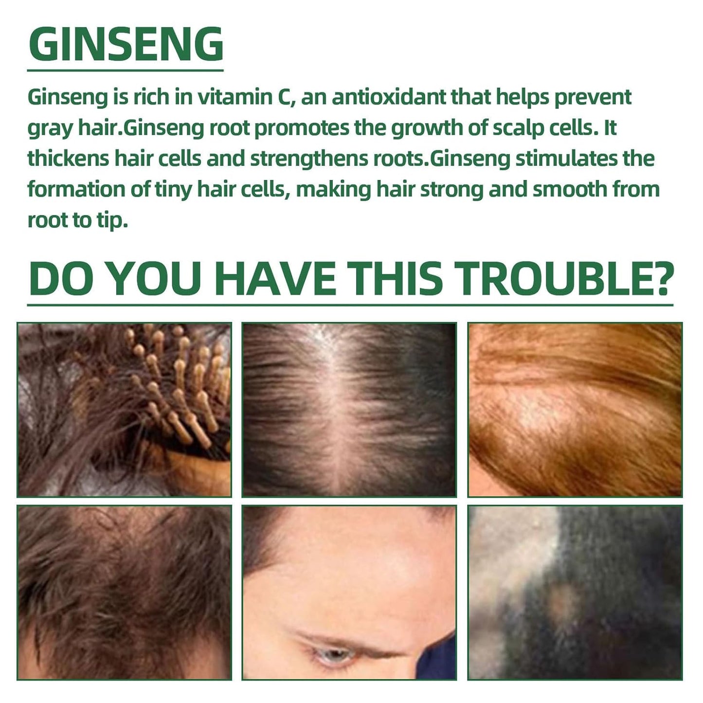 Hair Growth Spray for Women & Men - Natural Scalp Treatment with Ginseng,Ginger Root Extract,Anti Hair Fall Thickening Spray for Faster Regrowth (3.38 fl oz),2pcs