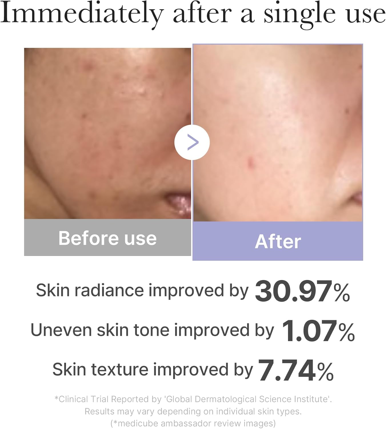 medicube Plump and Radiant Pink Duo: Mini Booster Pro Pink and Collagen Jelly Cream, 3.71 fl.oz. (110ml)