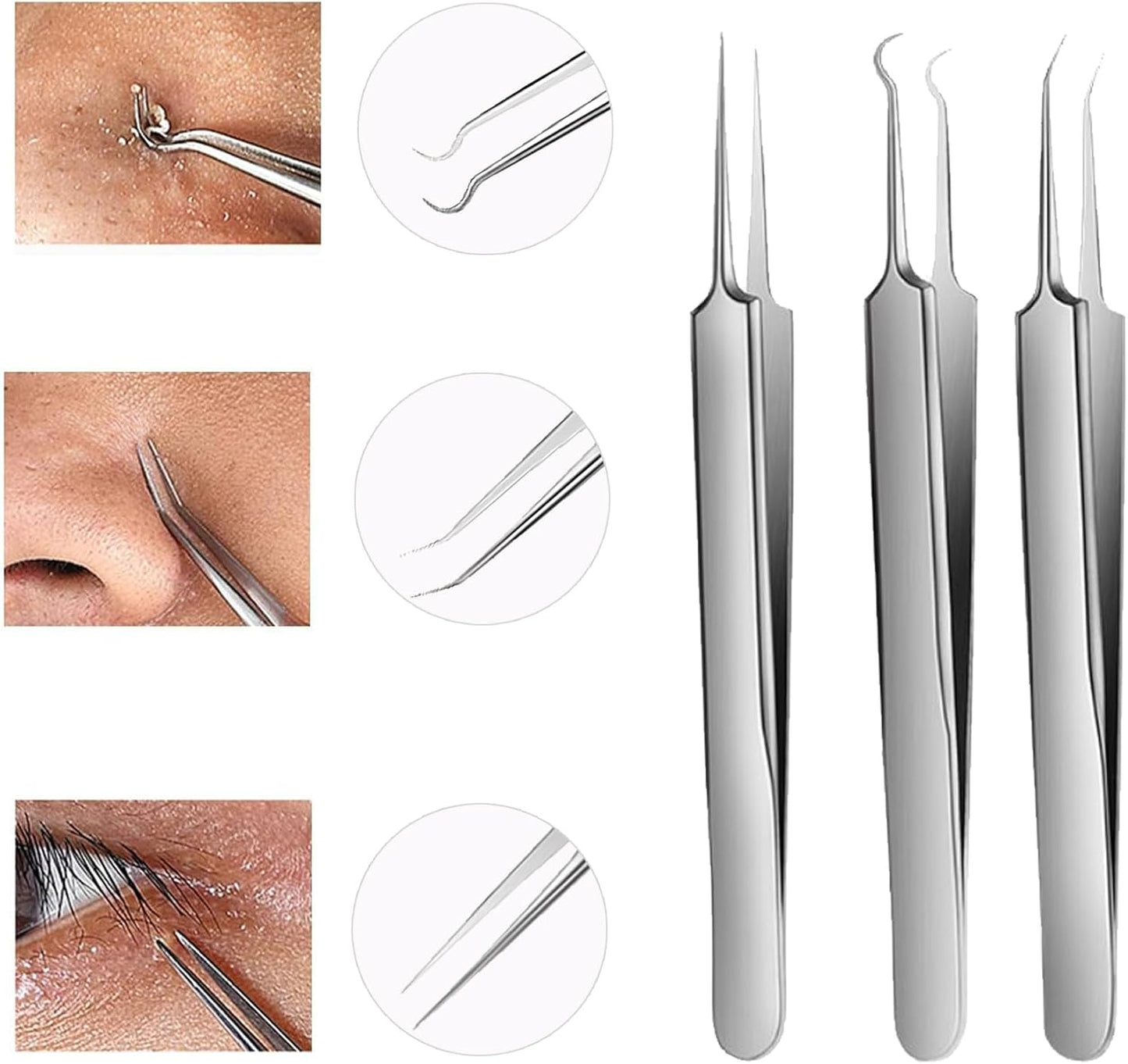 WSYUB Blackhead Tweezers, Blackhead Extractor, Pimple Popper Tool Kit, 3 in 1 Professional Stainless Skin Zit Acne Blemish Whitehead Popping Removing Surgical Tools Set, Silver