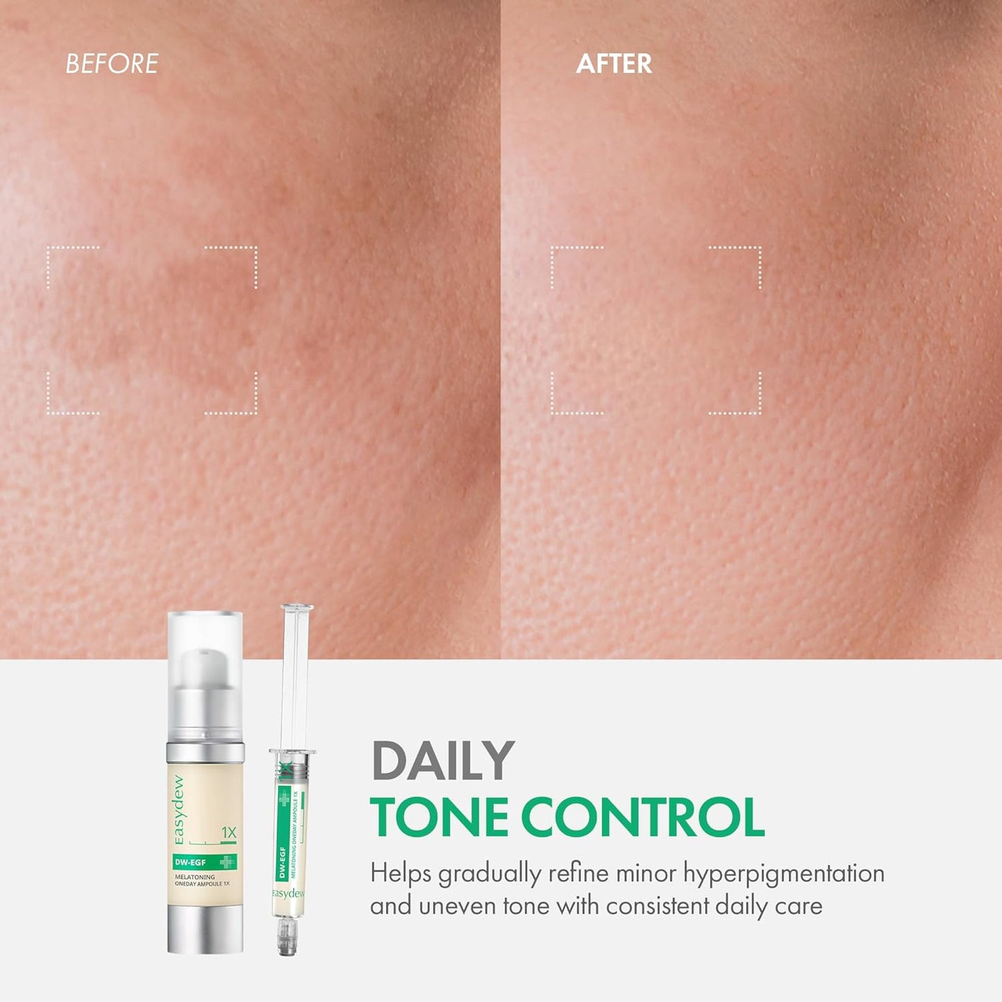 Easydew DW-EGF Melatoning Ampoule 1X - Hydrating Dark Spot Serum with Niacinamide & Glutathione for Uneven Skin - Fast Absorbing Day & Night Ampoule Korean Skin Care (Bottle 1.01 fl oz, EGF 1X)