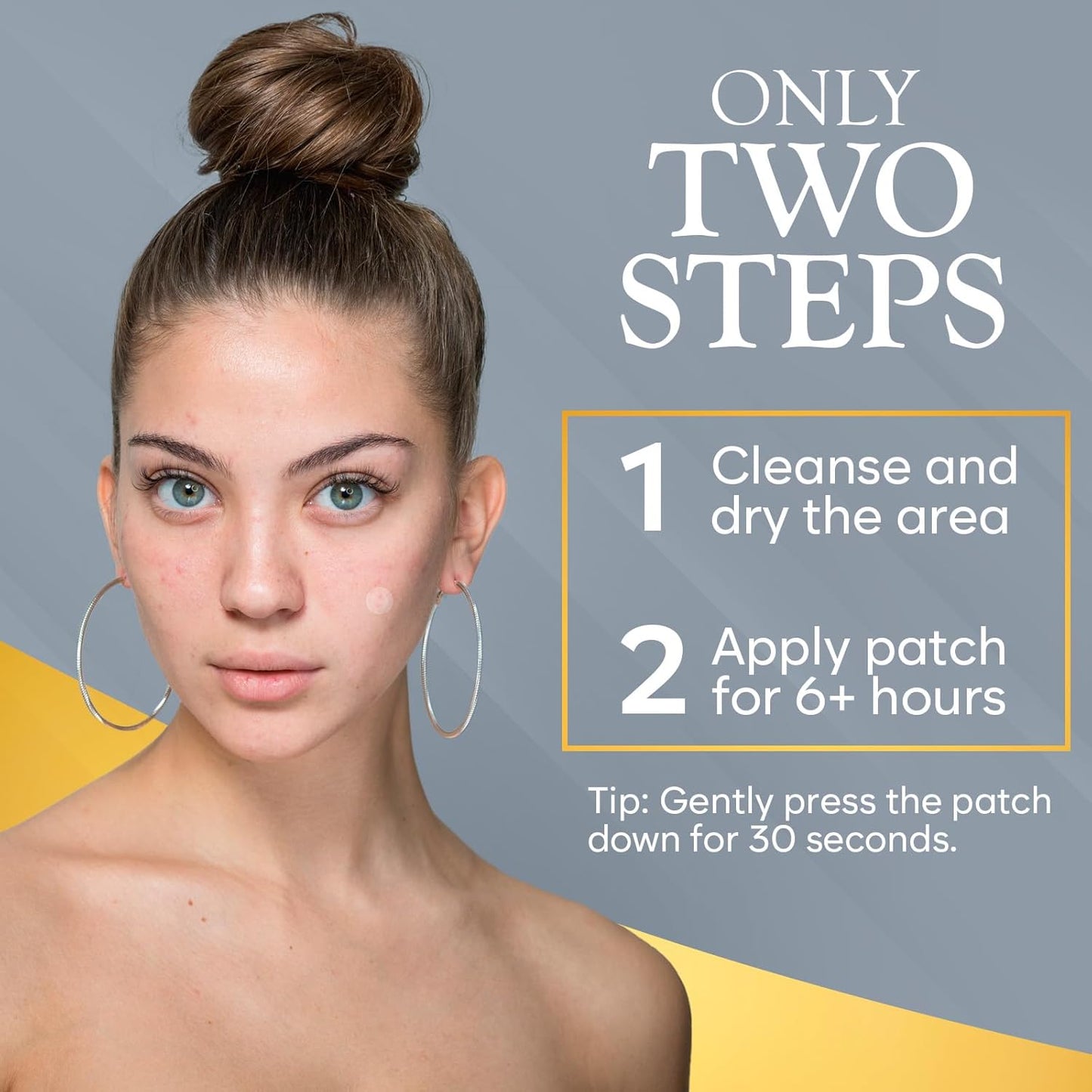 Microdart Acne Patch, Zit Patches for Cystic Acne Overnight Care, Cystic Acne Coverage, Pimple Patches Microdart Technology - Salicylic & Hyaluronic Acid (24 Count)