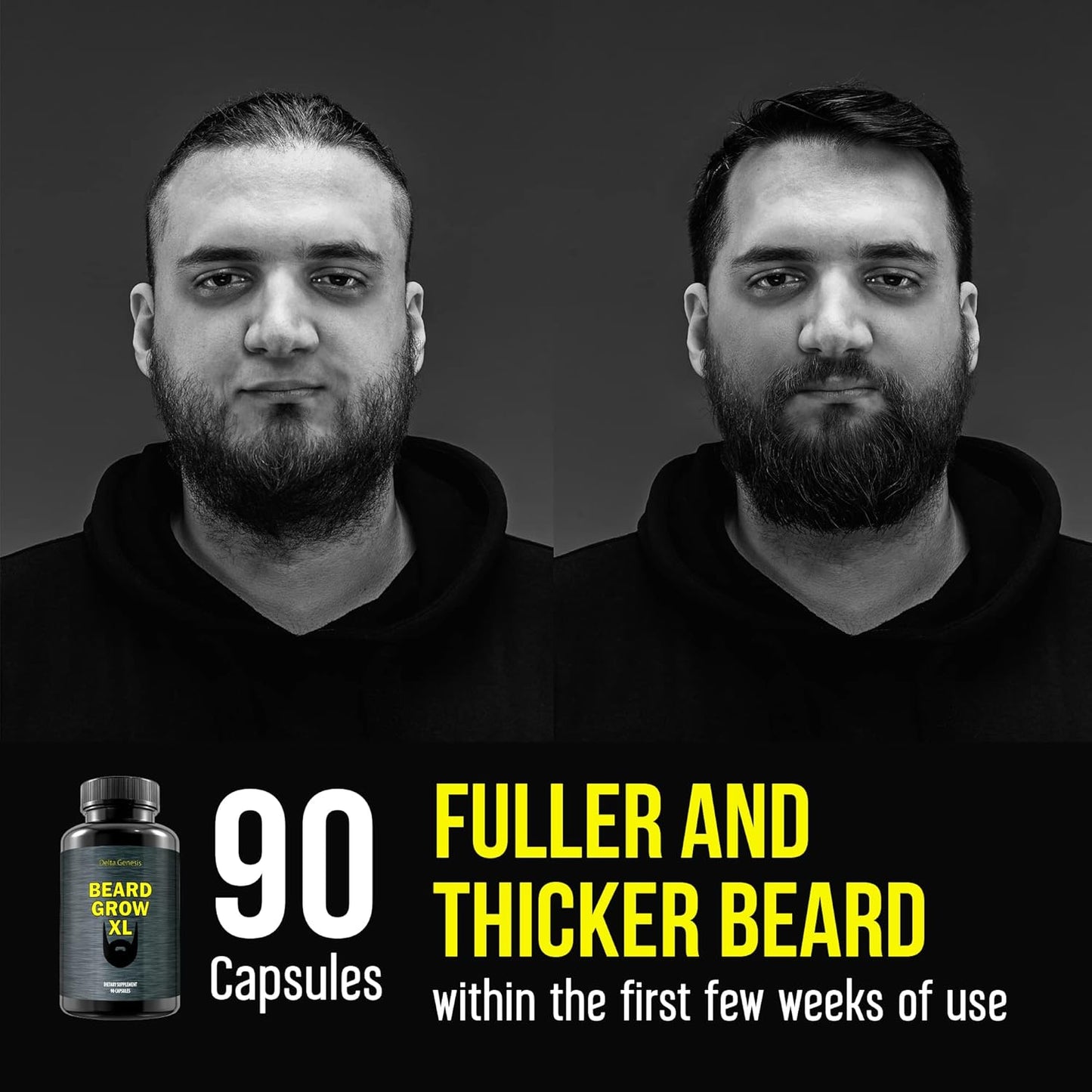 Beard Grow XL - Vegan Hair Growth Supplement for a Faster, Thicker, Fuller Beard - Enhances Your Grooming Kit