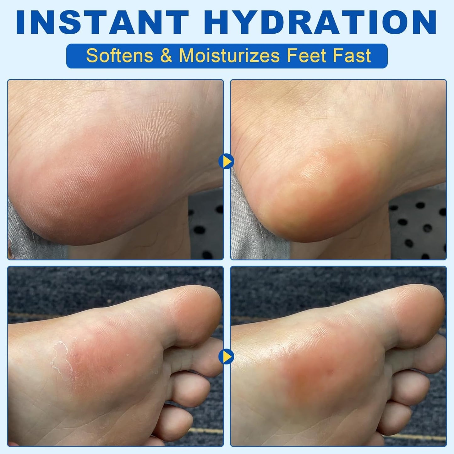 Foot Urea Cream, 60% Urea Cream for Feet Maximum Strength Repair Cracked Skin, Foot Moisturizer Nourish Cracking Rough Dry Heels, Feet Callus Remover Gel (2Pack)