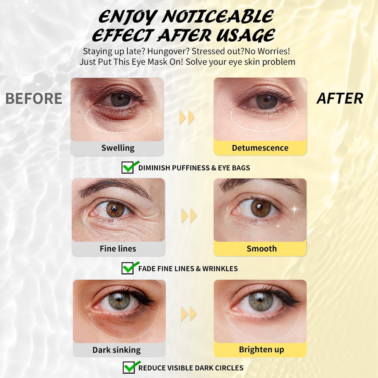 Under Eye Patches (8 Pairs), Hyaluronic Acid Eye Masks for Dark Circles Puffy Eyes Undereye Bags, Collagen Eye Patches for Wrinkles and Hydrate, Skin Care Gift for Her