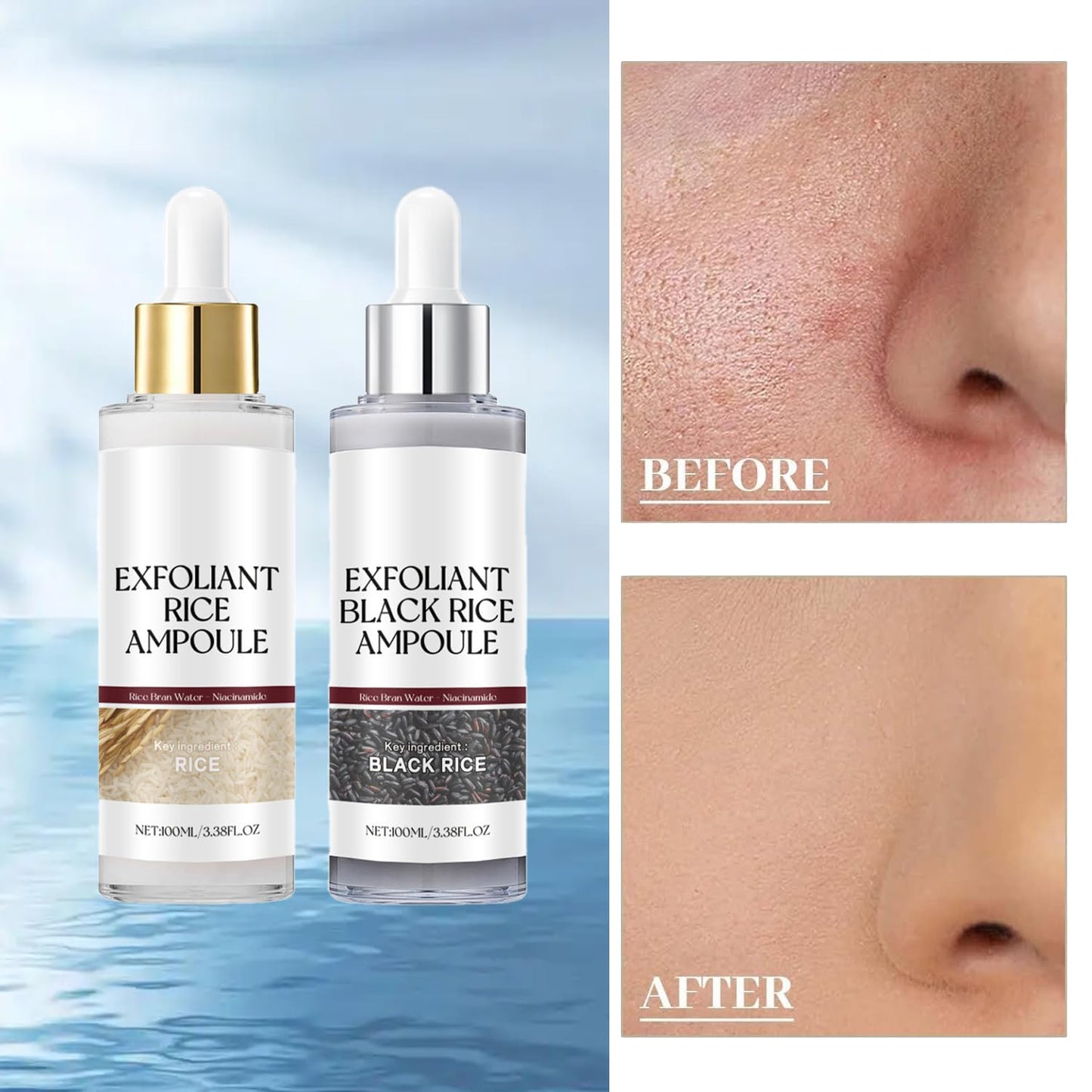 Black and White Rice Peeling, New Soft Rice Exfoliating Face and Body, Black and White Rice Exfoliant for All Skin Types, Gentle Peel & Deep Hydration (White+Black) 2pcs