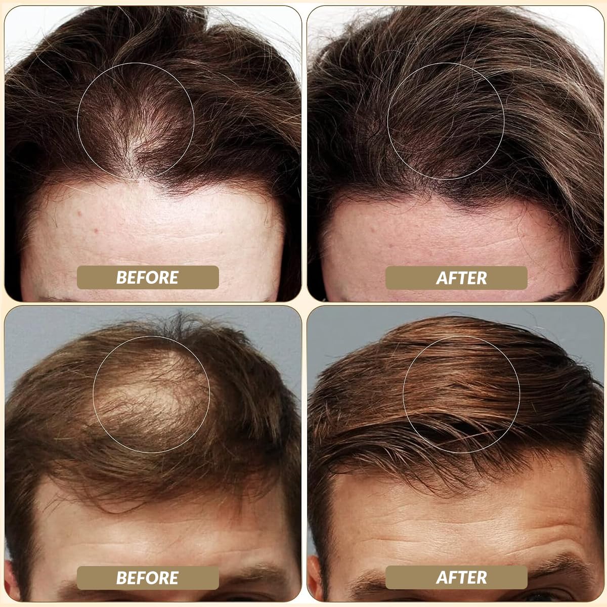 SOVONCARE Hair Fibers for Thinning Hair Light Brown, Hair Building Fibers for Bald Spots Undetectable & Natural, Conceals Hair Loss Fill In Fine Hair Powder Hair Thicker Instantly for Women & Men 28g