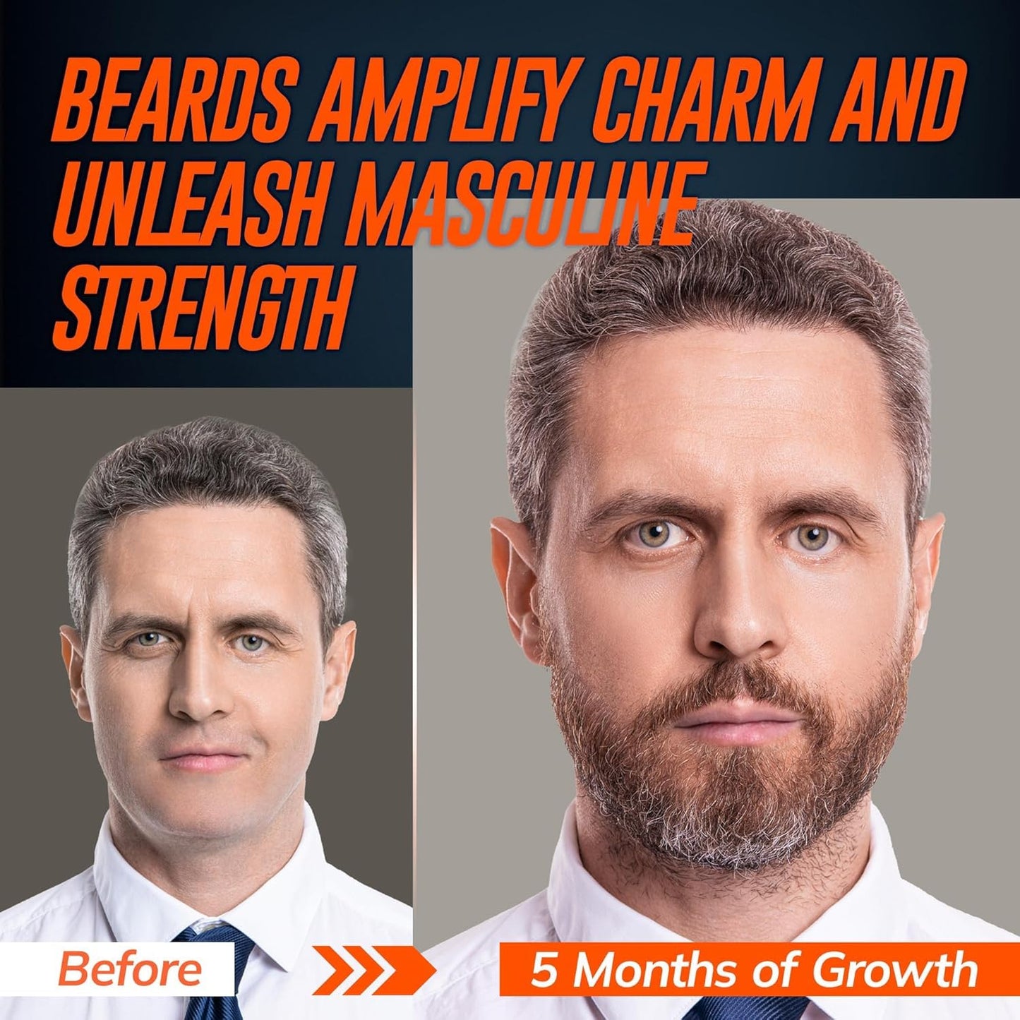 5% Minoxidil Beard Growth Serum for Men: 2-Pack Hair Regrowth Spray with Biotin & Rice Water - Extra Strength Beard Oil for Faster Thicker and Fuller Beard Growth - 4.06 Fl Oz