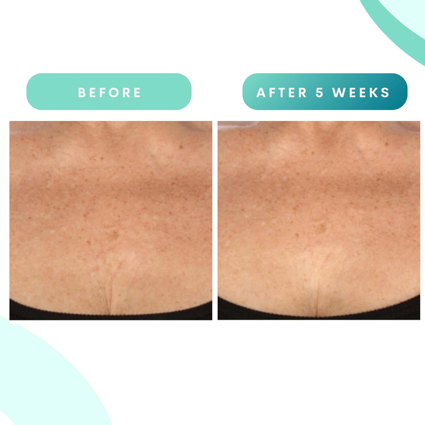 Serious Skincare - Glycolic Firming Retexturizing Body Cream - Moisturizing - Hydrating for Dry Skin - BODY FIT™ - For Crepey and Sagging Skin - Gentle Exfoliation for Smoother Skin - 8 Fl. Oz.