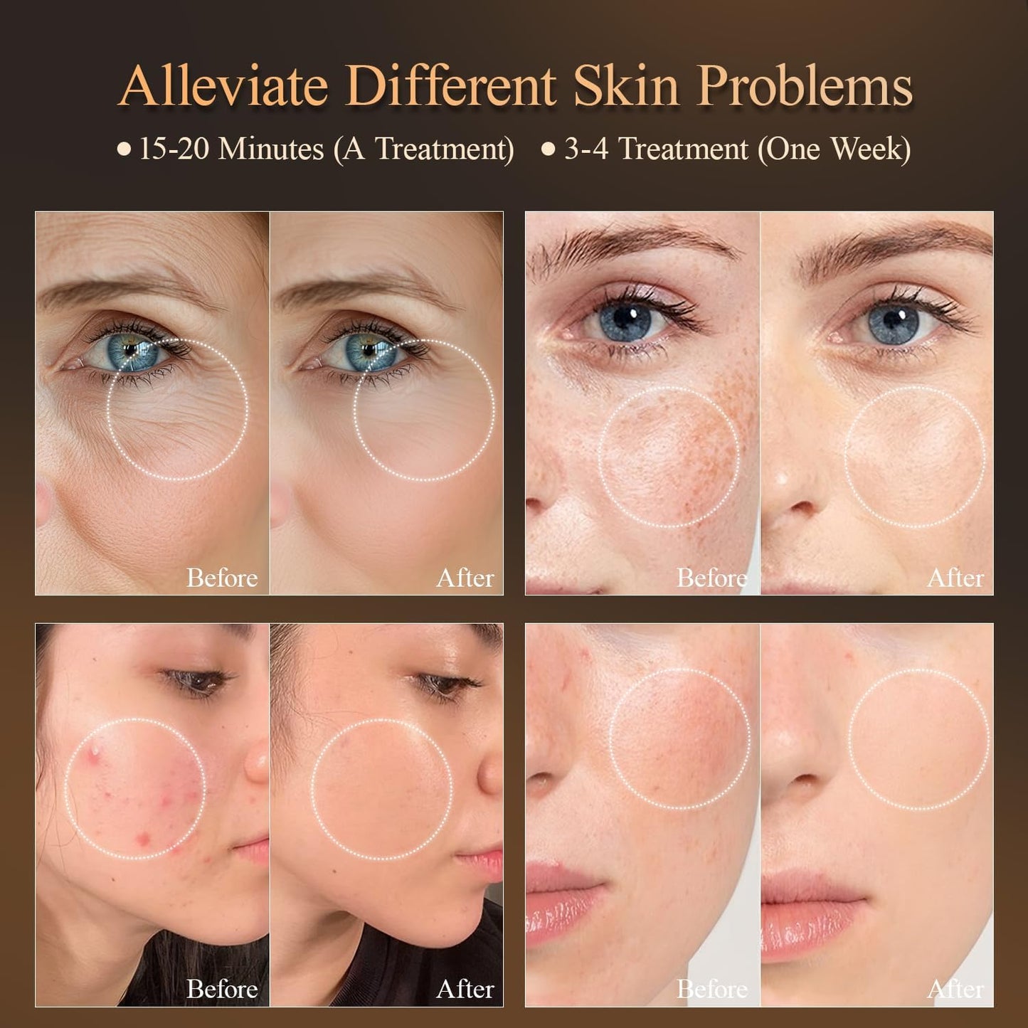 7 Colors Led Light Therapy Facial Mask, Face Light Therapy Mask for Face, Reduce Wrinkles Smooth Skin, Infrared Light Skin Rejuvenation(White)