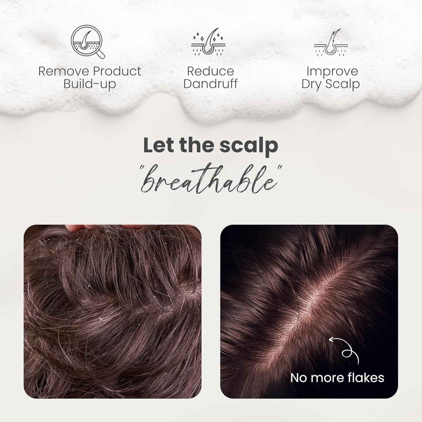 AIMIKE Silicone Bristle Shampoo Brush - Scalp Exfoliator for Hair Washing, Dandruff Removal, Growth Stimulation & Wet/Dry Usage