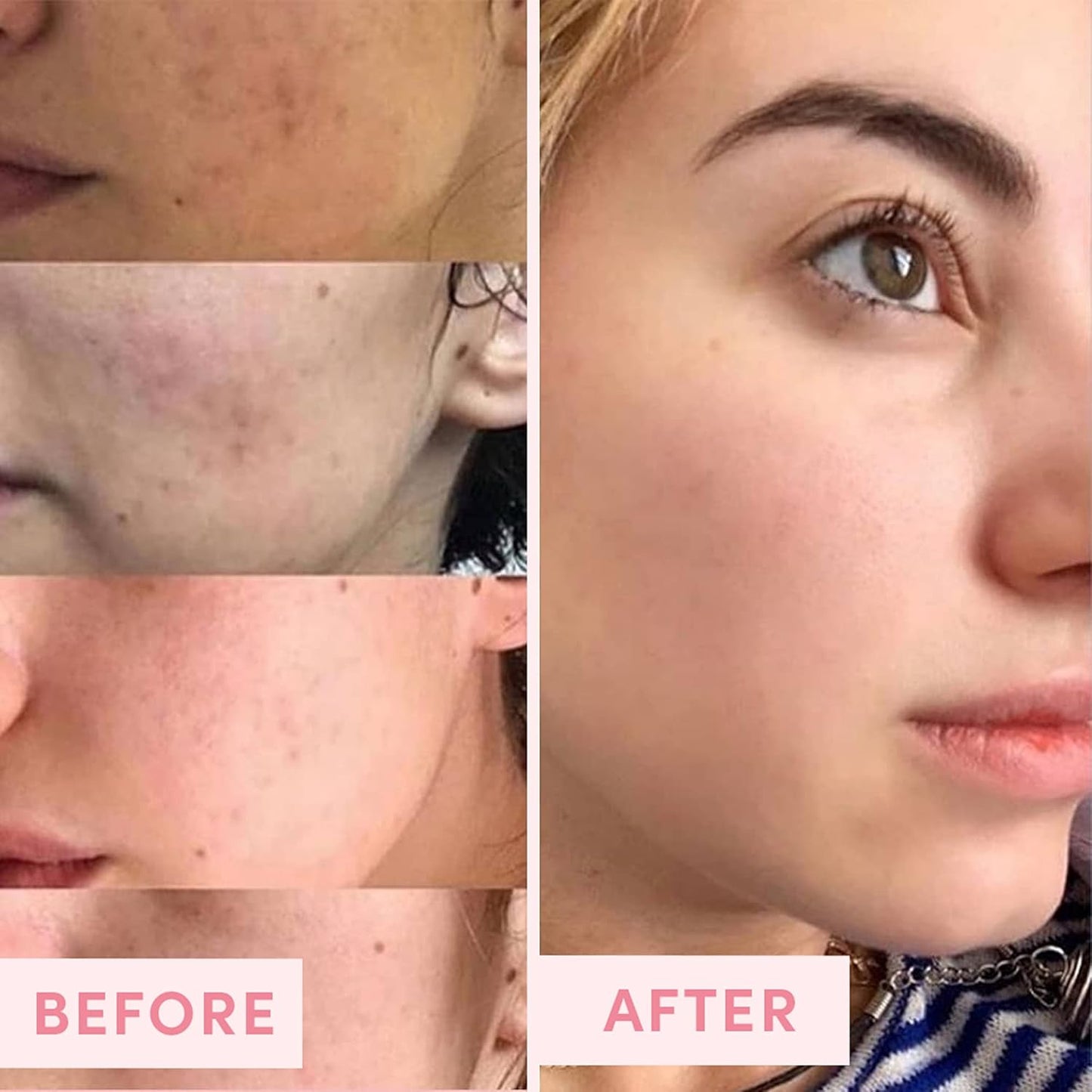 Sand & Sky Australian Pink Clay Detoxifying Face Mask with Vitamin C & Antioxidants - Pore Clearing Clay Mask for Blemish-Prone Skin, Fades Hyperpigmentation & Evens Tone