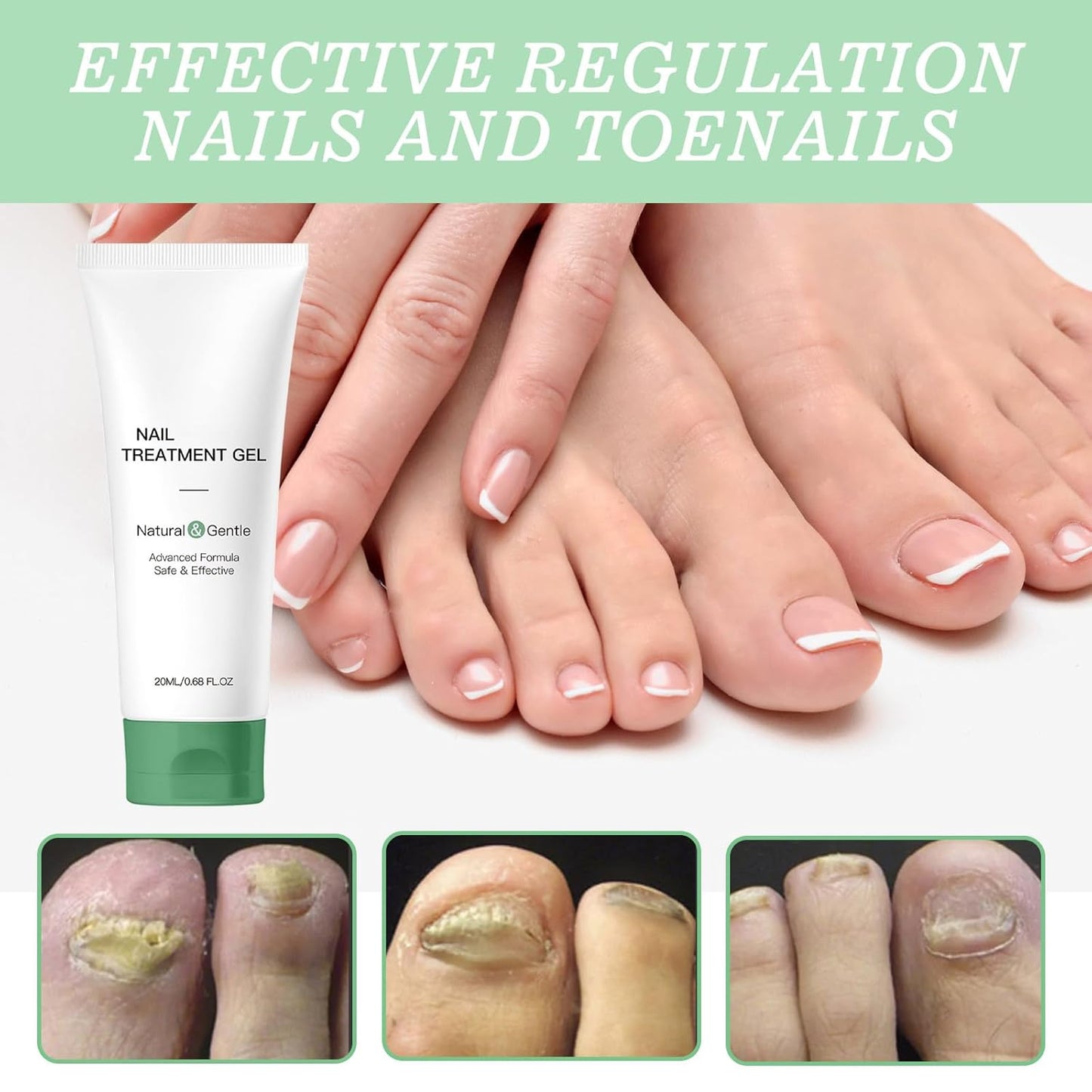 Nutraboost Nail Treatment, Nail Growth Serum for Repair & Strengthener,Multi-Purpose Nail Repair Oil Serum (1)