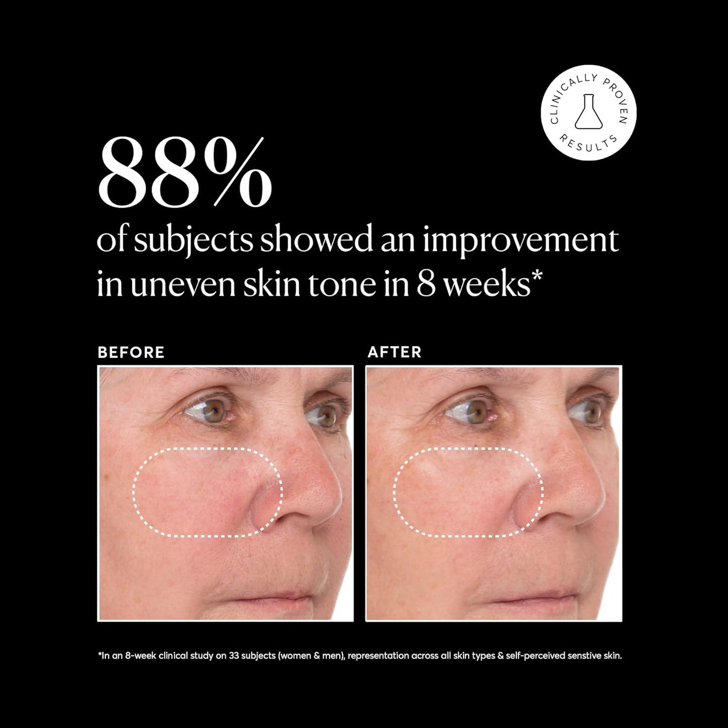 Naturium Vitamin C Super Serum Plus Jumbo, Smoothing Face Care, plus Retinol, Hyaluronic Acid, Niacinamide & Salicylic Acid, 2 oz