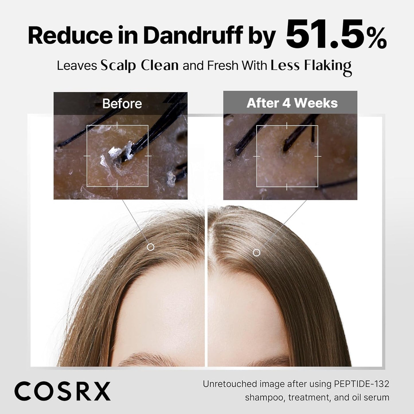 COSRX PEPTIDE 132 Hair Bonding Shampoo - Daily Scalp Treatment for Dandruff, Dry, Itchy or Flaky Scalp - Repairs & Strengthens Damaged Hair with Caffeine & Zinc PCA, For All Hair Types – 6.76 fl oz