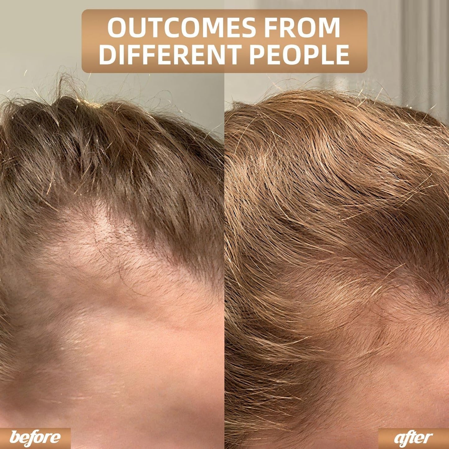 Red Light Therapy for Hair Growth, Breathable Cap Panels with Quick-Release Function