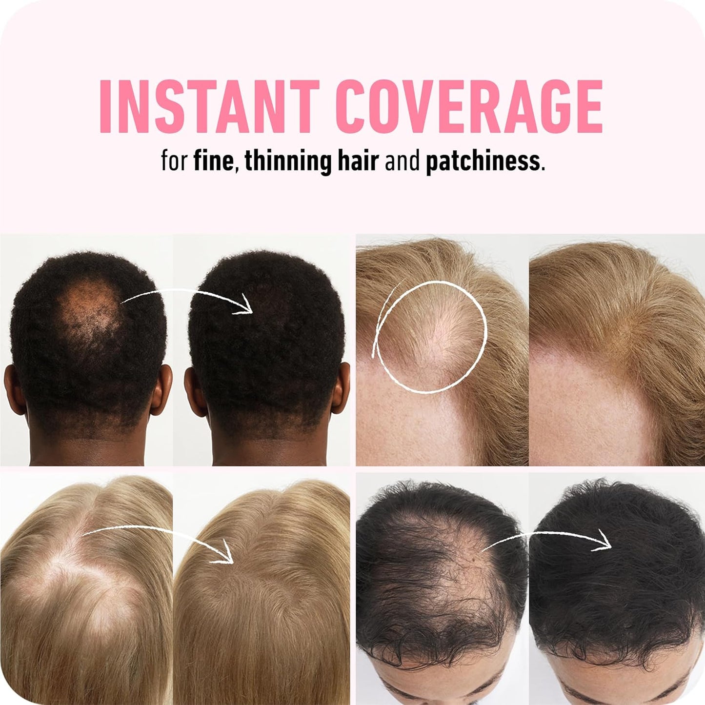 BOLDIFY Hair Fibers (12g) - Fill In Thinning and Fine Hair for an Instantly Fuller, Thicker Look - 14 Shades for Women & Men - Medium Brown