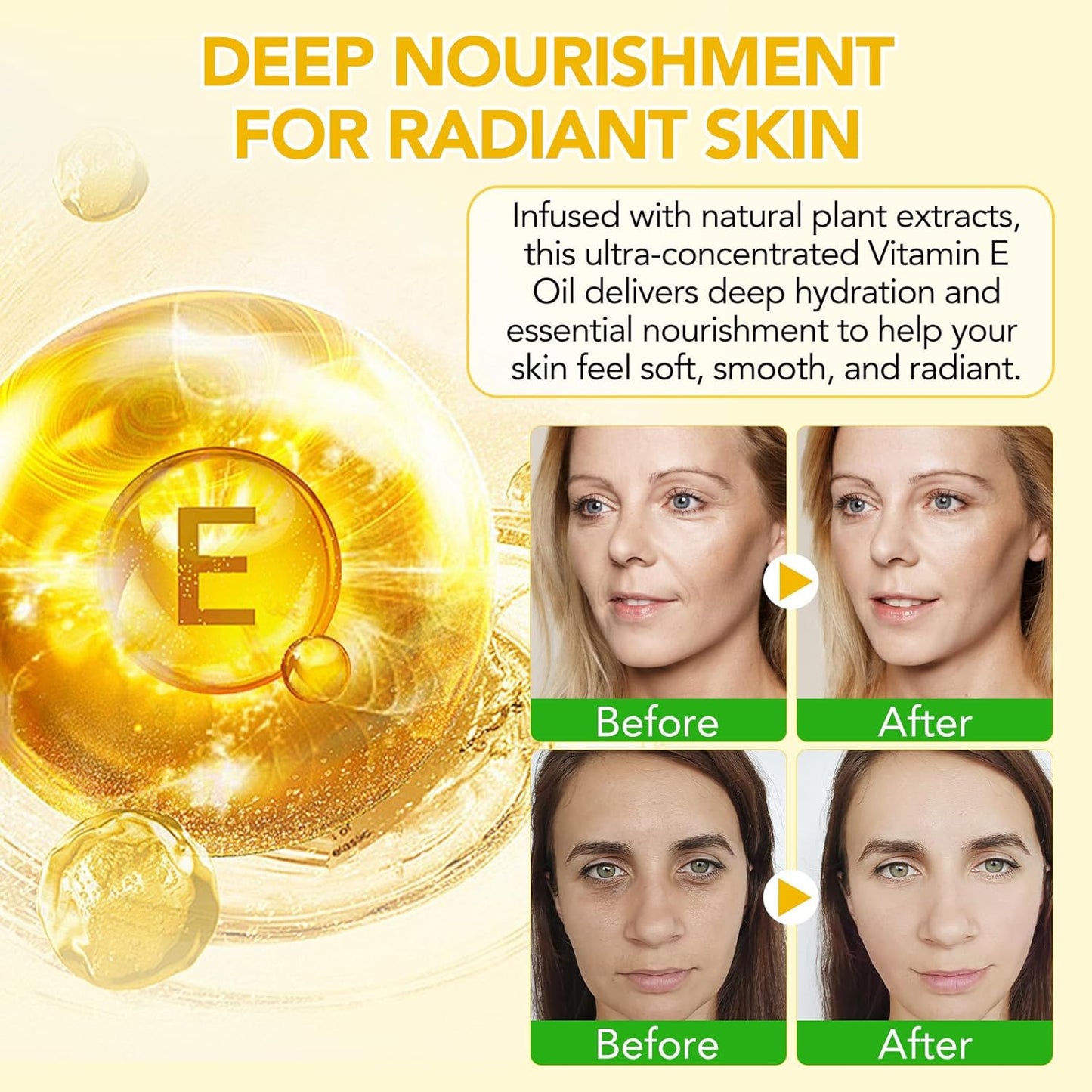 Vitamin E Oil for Skin 75,000 IU, 2Fl Oz Pure Vitamin e Oil for Scars, Hair, Face and Scalp, Moisturizing Dry Skin, Reduces Winkles and Fine Lines, Perfect Bath and Body Oils