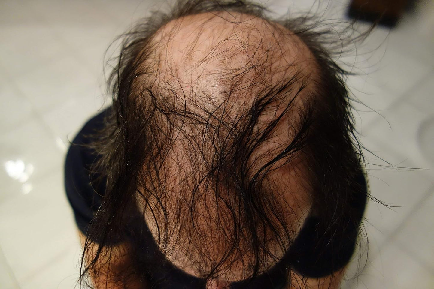 Hair Building Fibers 200 Grams 7 Oz. With Bottle By Finally Hair 50g*4 (Dark Grey and Pepper)