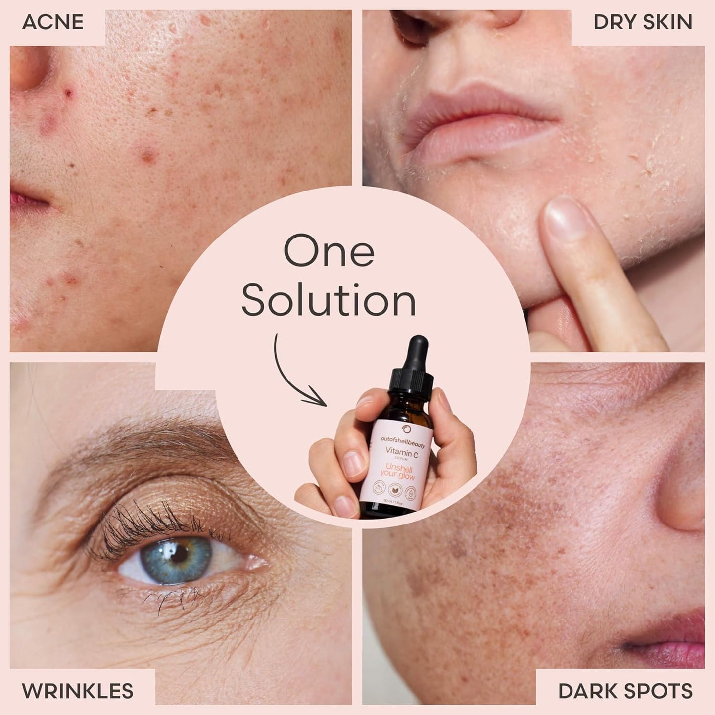 Vitamin C Serum for Face by Outofshell Beauty – 4-in-1 with Real Retinol, Hyaluronic Acid, Niacinamide – Brightening, Evens Skin Tone, Lightweight, No Irritation