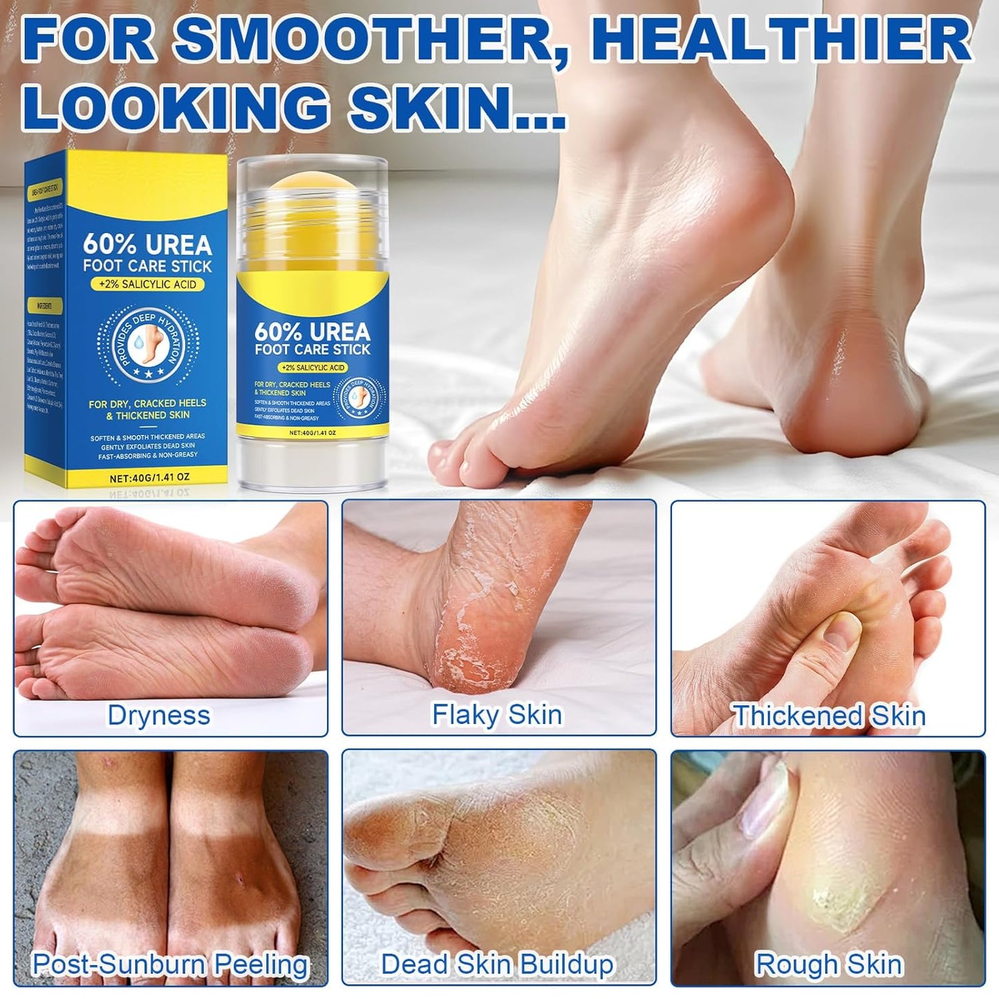 Foot Urea Cream, 60% Urea Cream for Feet Maximum Strength Repair Cracked Skin, Foot Moisturizer Nourish Cracking Rough Dry Heels, Feet Callus Remover Gel (2Pack)