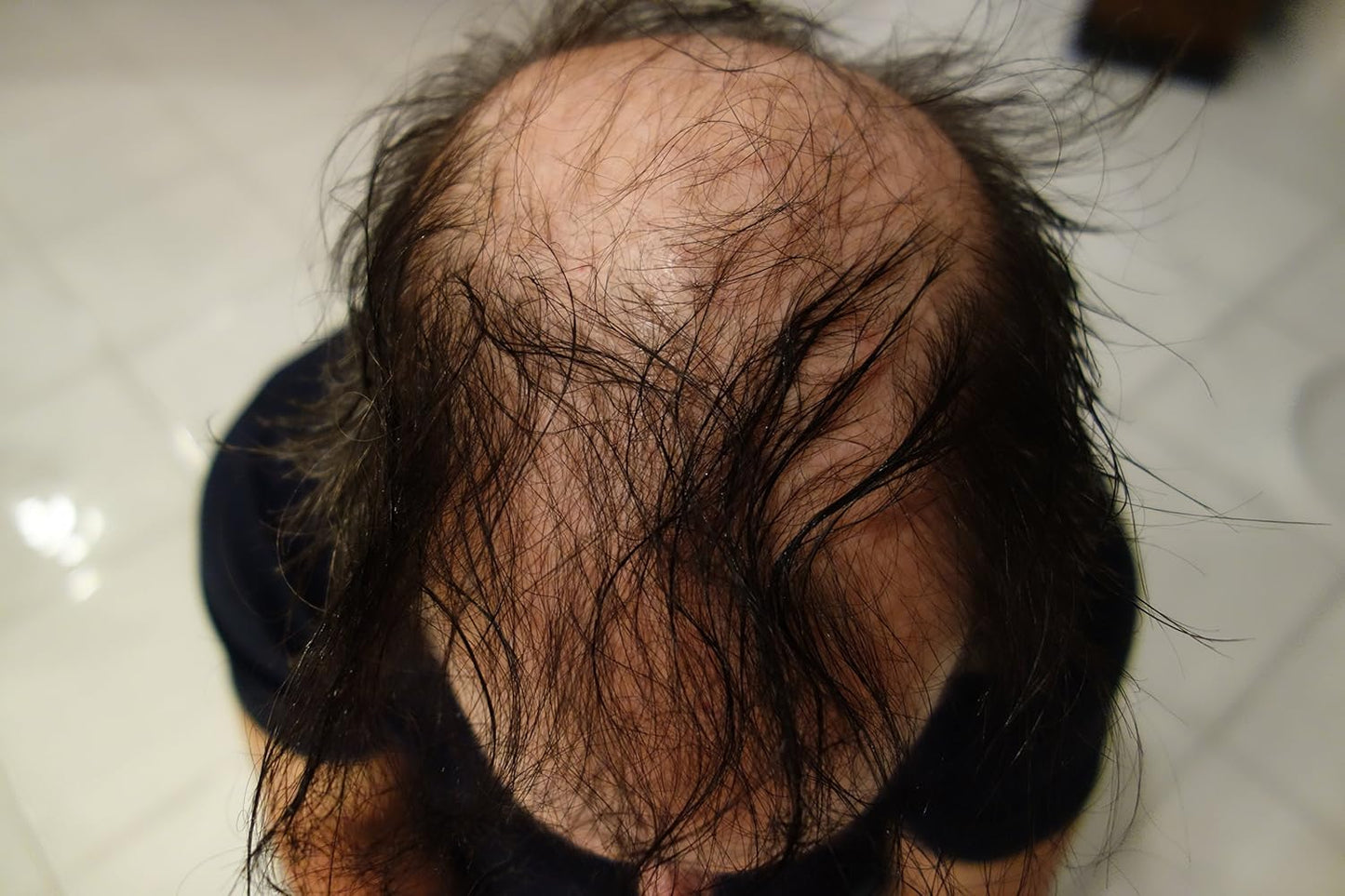 Hair Loss Concealer by Finally Hair - Auburn 28g Bottle of Fibers and Finally Hair 120ml 4.1 oz. Bottle of Fiber Lock Hair Spray - (Auburn)